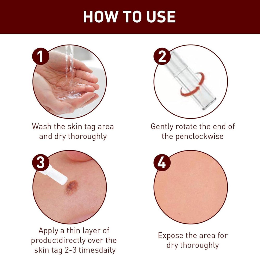 Last Day 50% OFF🔥Liquid Wart and Skin Tag Removal