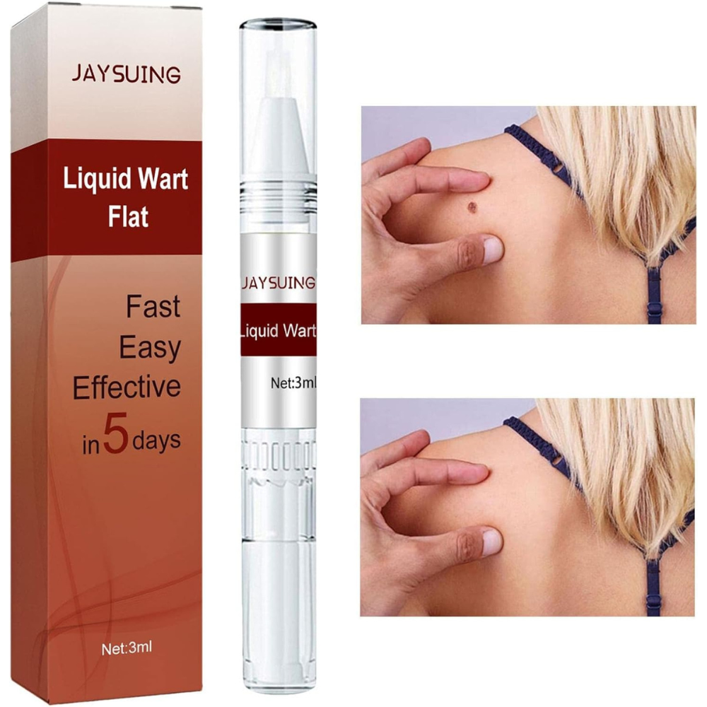 Last Day 50% OFF🔥Liquid Wart and Skin Tag Removal