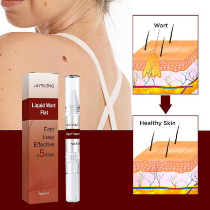 Last Day 50% OFF🔥Liquid Wart and Skin Tag Removal