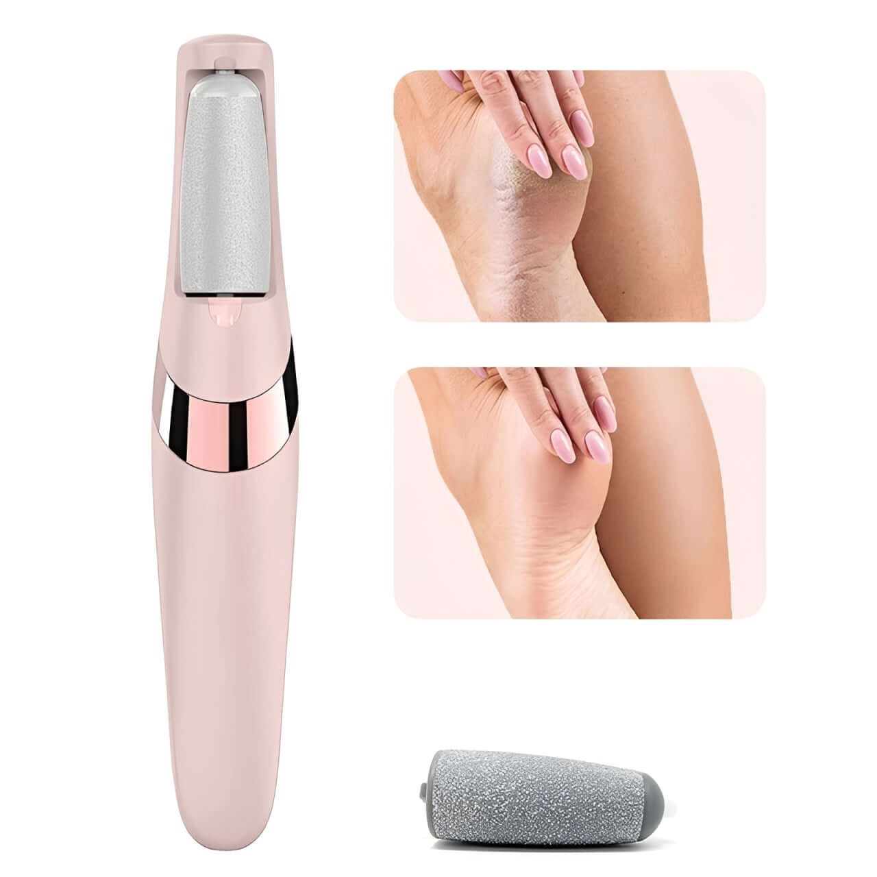 Electric Pedicure Foot File Callus Remover – Smooth & Soft Feet Care