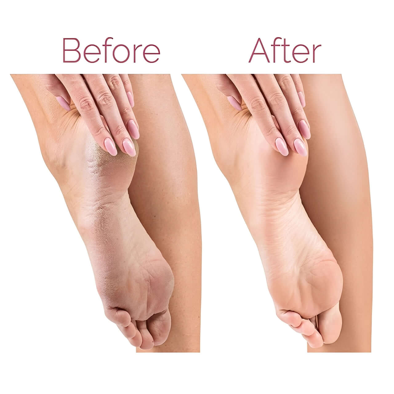 Electric Pedicure Foot File Callus Remover – Smooth & Soft Feet Care